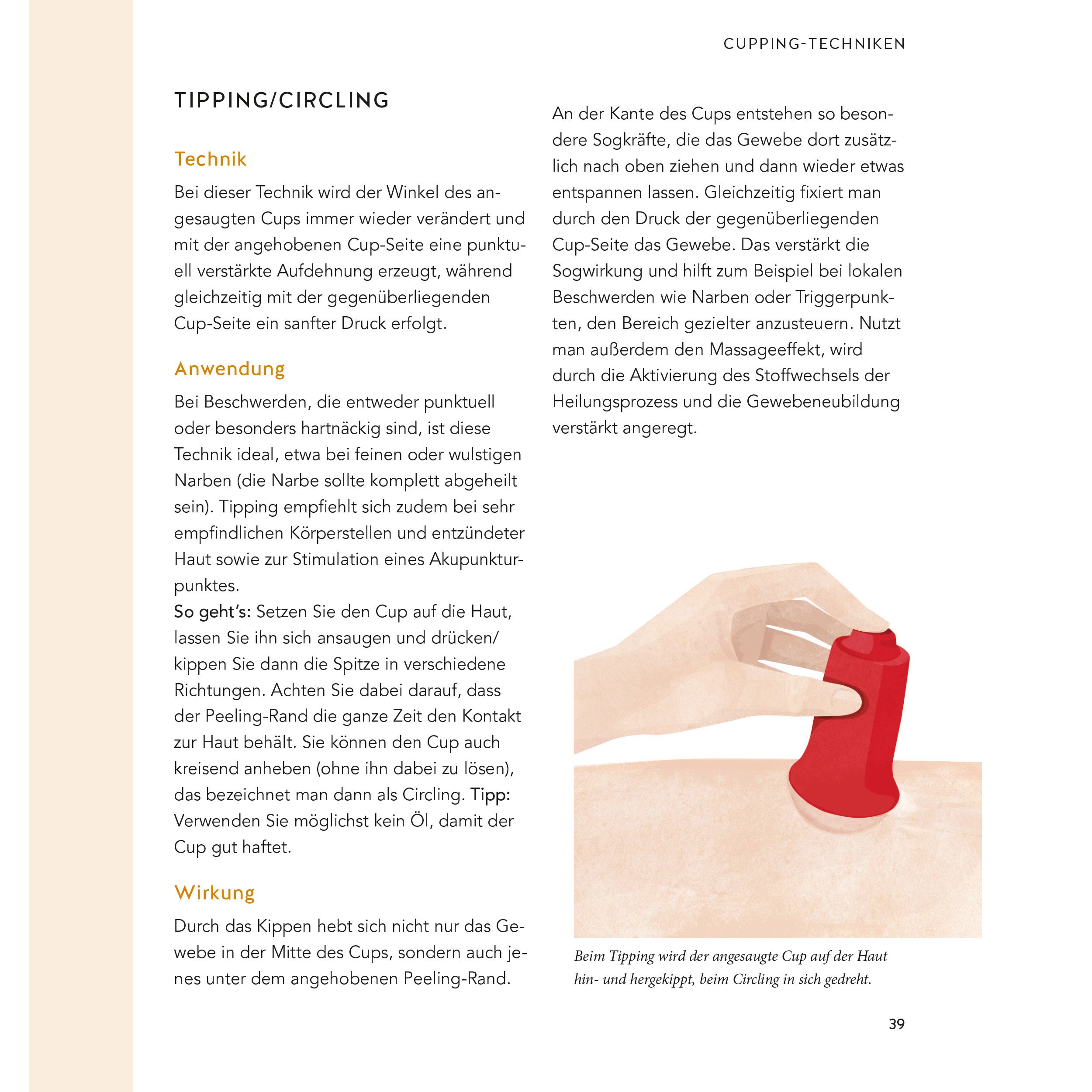 Cupping - die neue Methode zum Lösen der Faszien